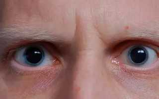 Зрачки наркомана: как определить зависимость по глазам и как наркоманы маскируют взгляд