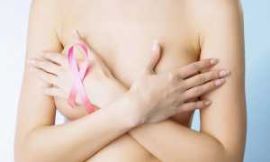 Особенности профилактики рака молочной железы
