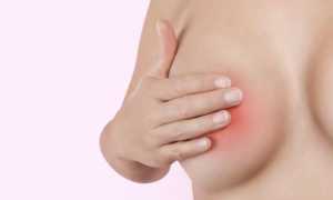 Фиброаденома молочной железы: симптомы и разновидности