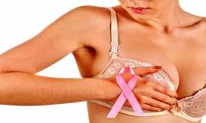 Особенности инвазивного рака молочной железы