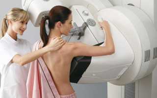 Особенности цифровой маммографии