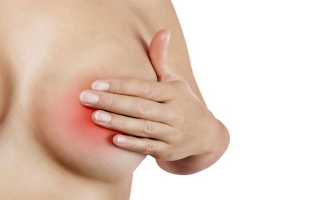 Особенности массажа груди при лактостазе