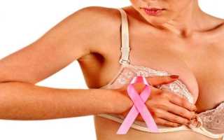 Основные причины рака молочной железы у женщин