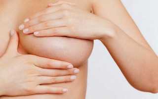 Особенности онкологии груди у женщин