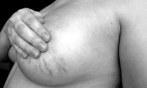 Как сохранить грудь после родов и кормления