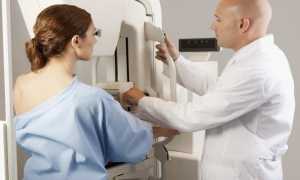 С какого возраста делают маммографию молочных желез