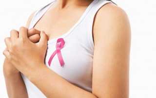 Что такое инфильтрирующий дольковый рак молочной железы