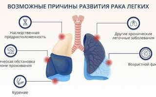 Стаж, причины, признаки и профилактика рака легких от курения