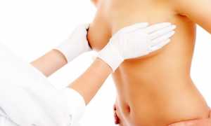 Лечение мастопатии молочной железы